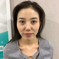 铂金美白果怎么样?【真实案例为大家呈上】