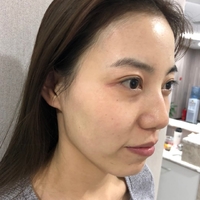 铂金美白果怎么样?【真实案例为大家呈上】