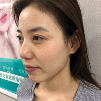 铂金美白果怎么样?【真实案例为大家呈上】