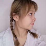 祁佐良下颌角整形案例分享：硬核老爸支持我做下颌角变成小V脸 width=