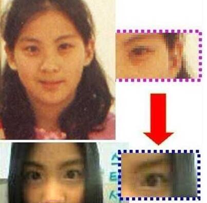 金鱼眼整形果如何，还能让自己美美哒的吗?