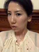 四川米兰柏羽经过负压冰点除皱恢复我十年青春~ width=