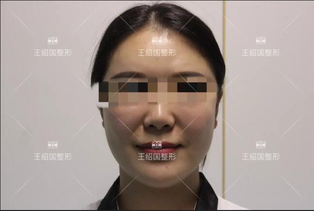 王绍国去贵吗