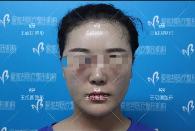 王绍国去贵吗