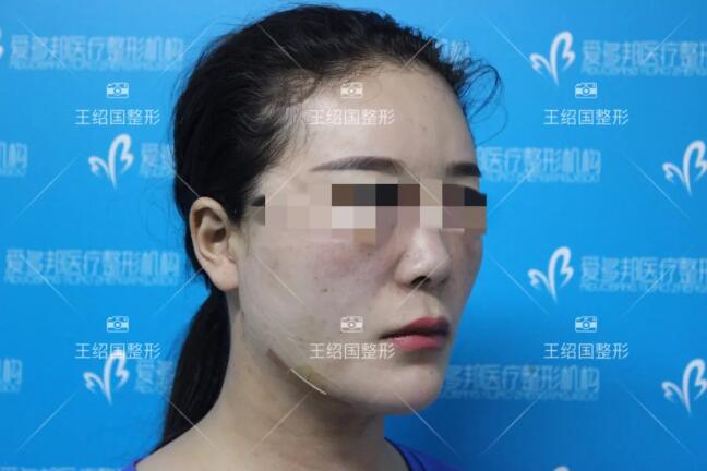 王绍国去贵吗