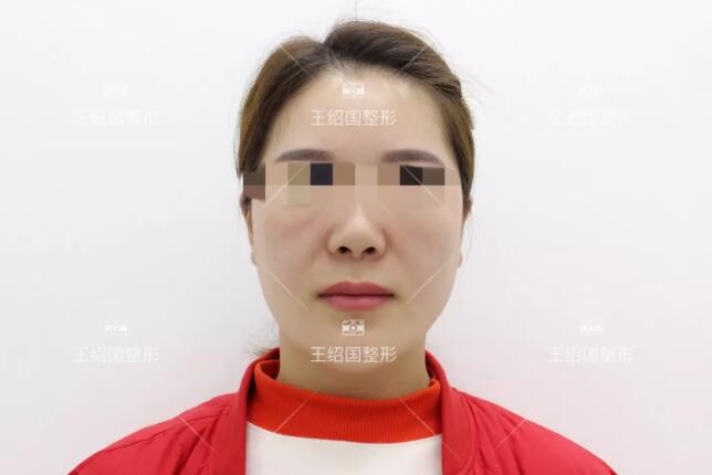 王绍国去贵吗