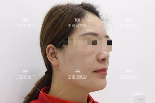 王绍国去贵吗