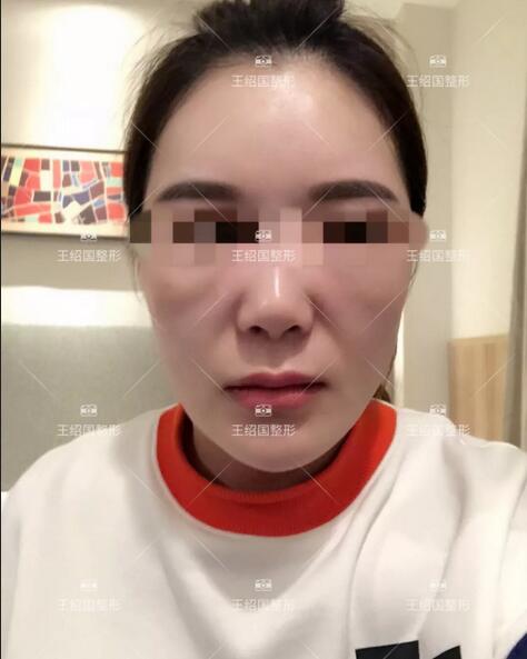 王绍国去贵吗