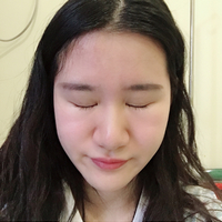 鼻骨缩窄手术多少钱?从此让你也能拥有一个鼻子