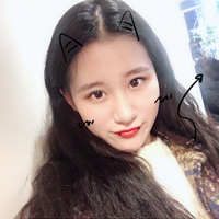 鼻骨缩窄手术多少钱?从此让你也能拥有一个鼻子