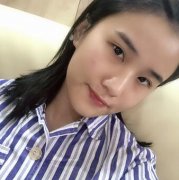 西昌整形专家汤颖峰割双眼皮20天后很自然微创~ width=