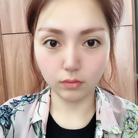 下颌角截骨整形技术如何?内附静蔓整形果图