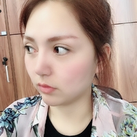 下颌角截骨整形技术如何?内附静蔓整形果图