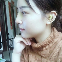 鼻头缩小对比图，真人诠释鼻头缩小后果