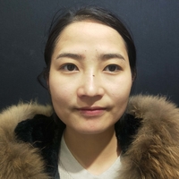 面部光纤溶脂多久起?真人日记为你解答