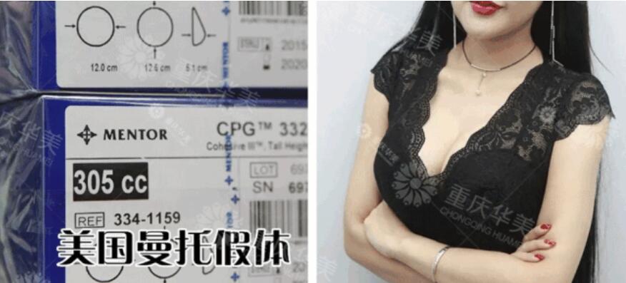 【没问题隆胸术本应该是怎样的|切忌盲目隆胸酿大错！】