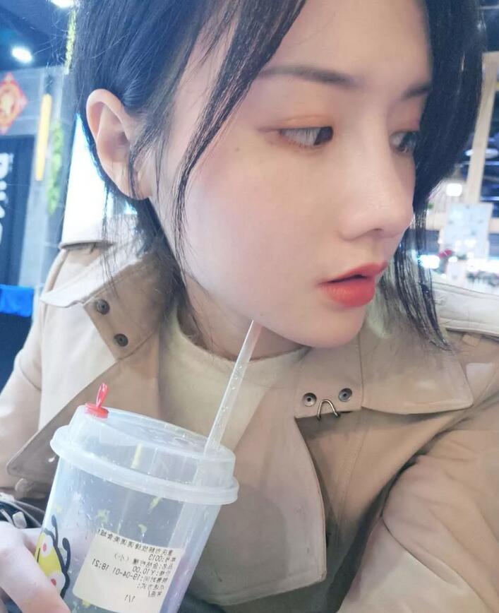 【党宁鼻翼缩小+鼻尖成形术前后对比图-见证婷婷的蜕变】