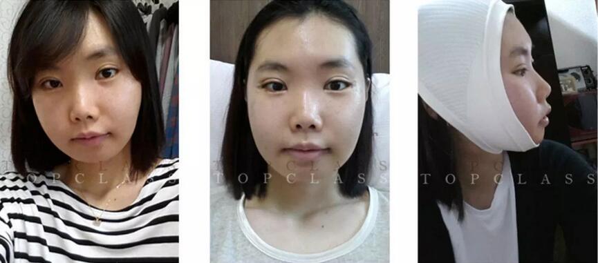 崔慧妍