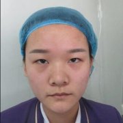 赵博士整形美容医院价格表 【成都二娃的翘睫双眼皮恢复分享】 width=