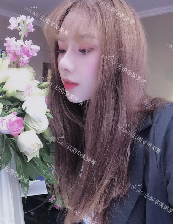 塌鼻子隆鼻前后对比