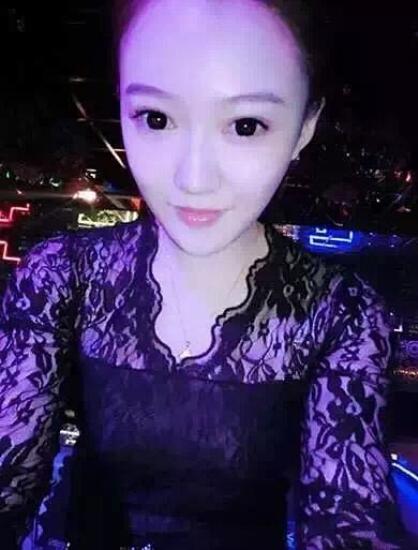 上海知音医院娜琦丽假体隆胸3个月，果好到爆！