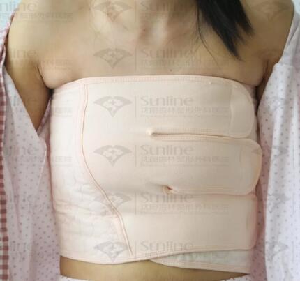 哺乳喂奶之后乳房下垂怎么办？刘建波假体隆胸立马安排！