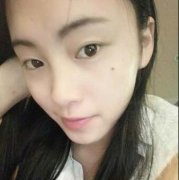 米兰柏羽卢尚兵美杜莎双眼皮案例1VS99天对比图~宛如古希腊女神美杜莎 width=