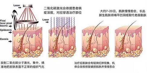 汗管瘤的调节方法有哪些安？我查到了这些资料~