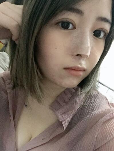 崔理允华美紫馨垫鼻子危险吗，内附价目表一览~