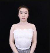倪彬自体脂肪隆胸案例，真实记录镁铝蜕变过程~ width=