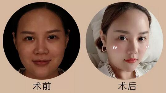 大连艺星整形医院推出美肤神器“Mini天使肌”，只要311！