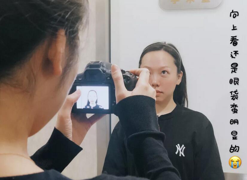 雅皙祛眼袋有吗？真人真事儿可以说明哟！ width=