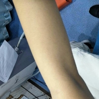 shr冰点脱毛价格贵吗?来自小姐姐的真情诉说