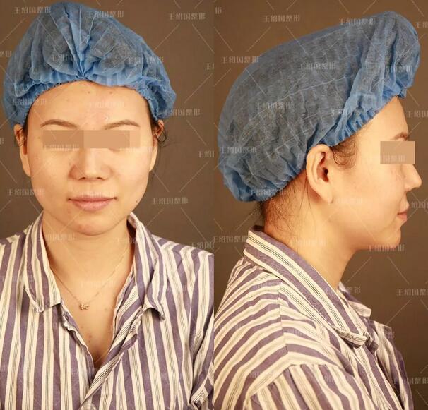 爱多邦黎星院长面部加减案例——“驻颜术”越活越年轻的秘密~