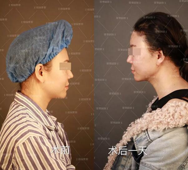 爱多邦黎星院长面部加减案例——“驻颜术”越活越年轻的秘密~
