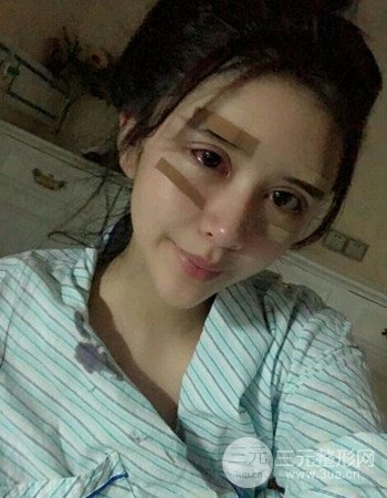 仁雁光乳化祛眼袋究竟靠不靠谱？我用亲身经历告诉你！