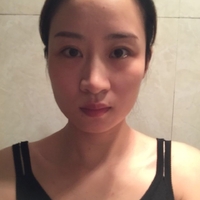下颌角接骨整形技术到底如果?听说果还不错耶~~~
