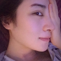 下颌角接骨整形技术到底如果?听说果还不错耶~~~