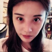 【修志夫水滴鼻对比图皂片】变美第二步鼻子的变化 width=