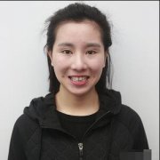 美齿冠真实恢复日记：15天还你一口整齐小白牙 width=