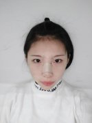 陈先才耳软骨隆鼻对比图日记分享：真实案例改变面相 width=