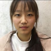伽美整形医院切开双眼皮+开眼角对比图分享：肿泡眼秒变桃花眼~ width=
