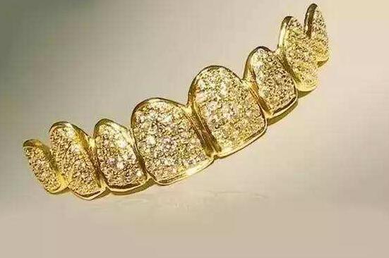 黄金烤瓷牙的价格大概多少比较合理?