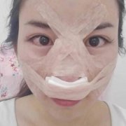 伊美尚怎么样?水滴鼻对比图76天宛如天仙~ width=