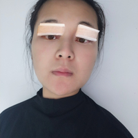 成都米亚整形口碑如何?我想到此做个双眼皮