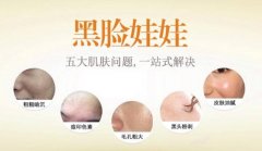 黑脸娃娃去黑头果怎么样? width=