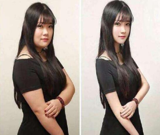 超声吸脂减肥会有副作用吗?