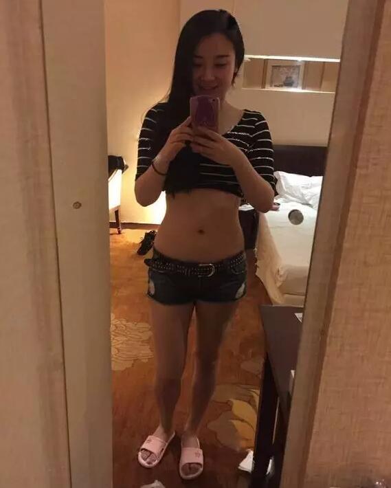 韩式共振吸脂减肥果好吗?真实案例呈上