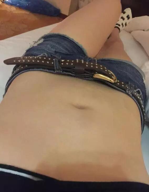 韩式共振吸脂减肥果好吗?真实案例呈上