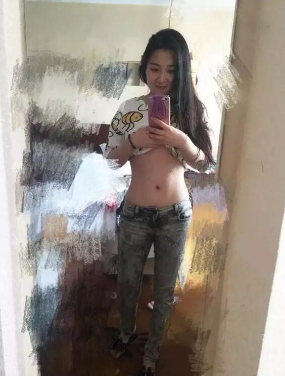 韩式共振吸脂减肥果好吗?真实案例呈上